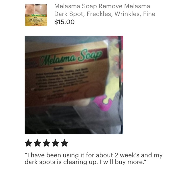 roswinda melasma soap